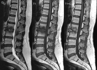 radiografía columna vertebral