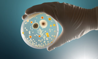 Placa de agar llena de bacterias